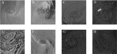 Submesoscale oceanic eddy detection in SAR images using context and edge association network